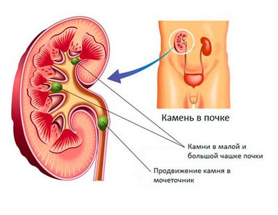 лечение