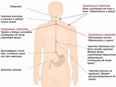 симптом симптом