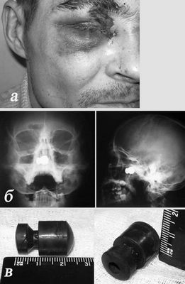 устройство