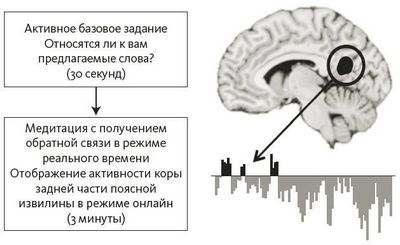 мозг мозг