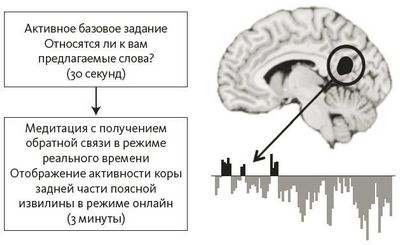 мозг