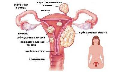вакцина вакцина