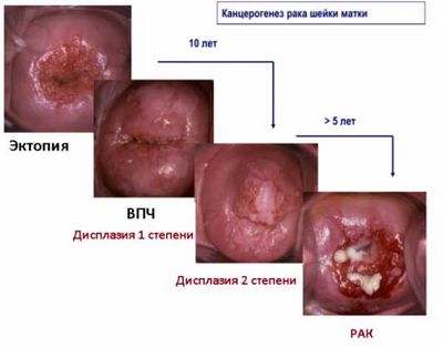 результат результат