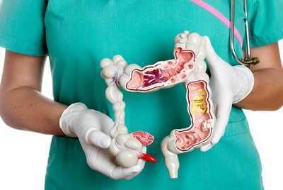 Обзор новых данных о лечении дивертикулита толстой кишки может помочь врачам