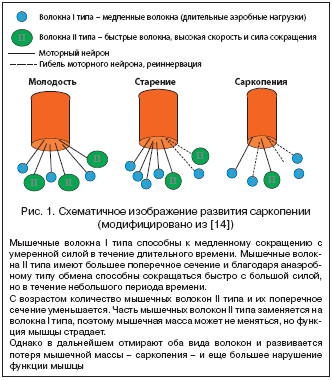 Низкая скорость обработки предсказывает падения у пожилых людей