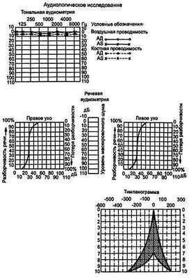 Исследование объясняет эффект коктейля при нарушении слуха