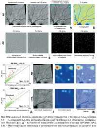 Технология визуализации сетчатки для раннего выявления болезни Альцгеймера